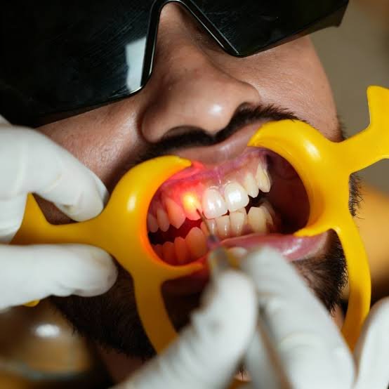 Laser Dentistry Treatments